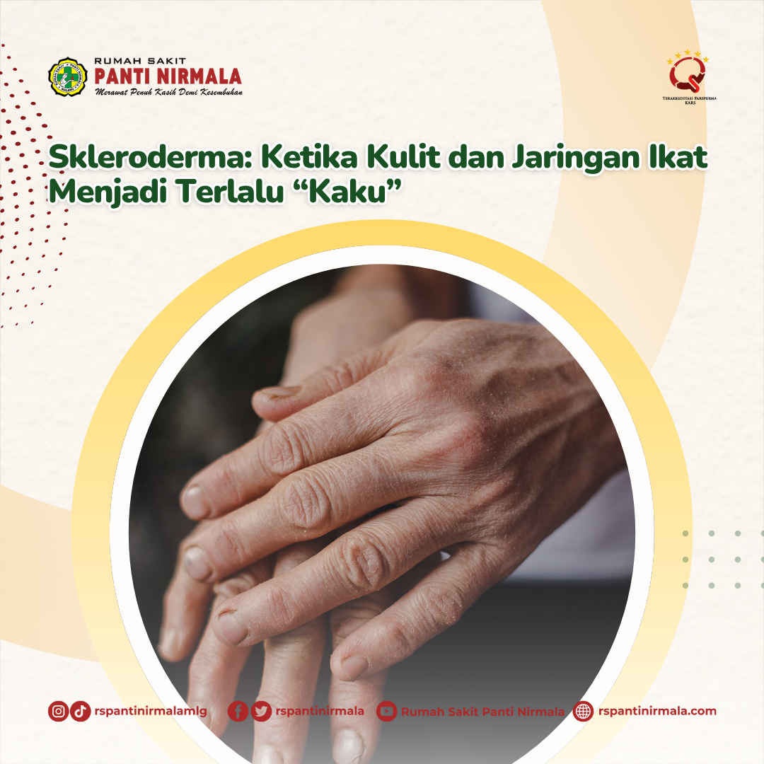 Skleroderma: Ketika Kulit dan Jaringan Ikat Menjadi Terlalu “Kaku”